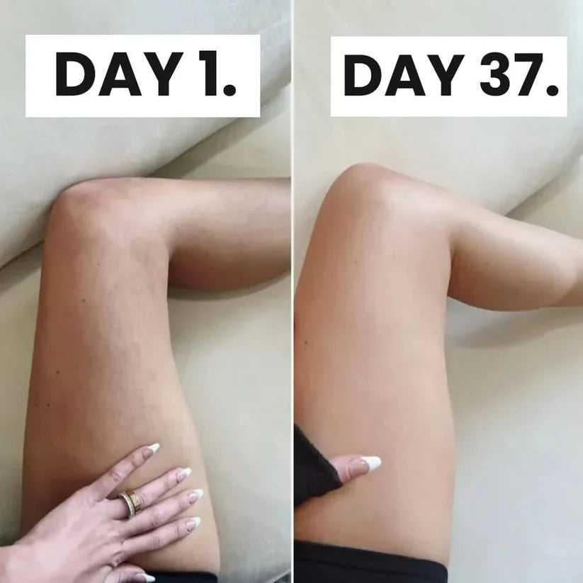 Velvace™ Cellulite Relief Kit